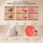 Masque LED Nouvelle Génération
